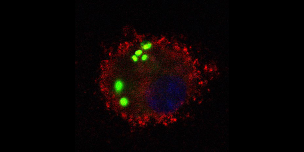 Researchers Target a Mouse’s Own Cells, Rather Than Using Antibiotics, to Treat Pneumonia